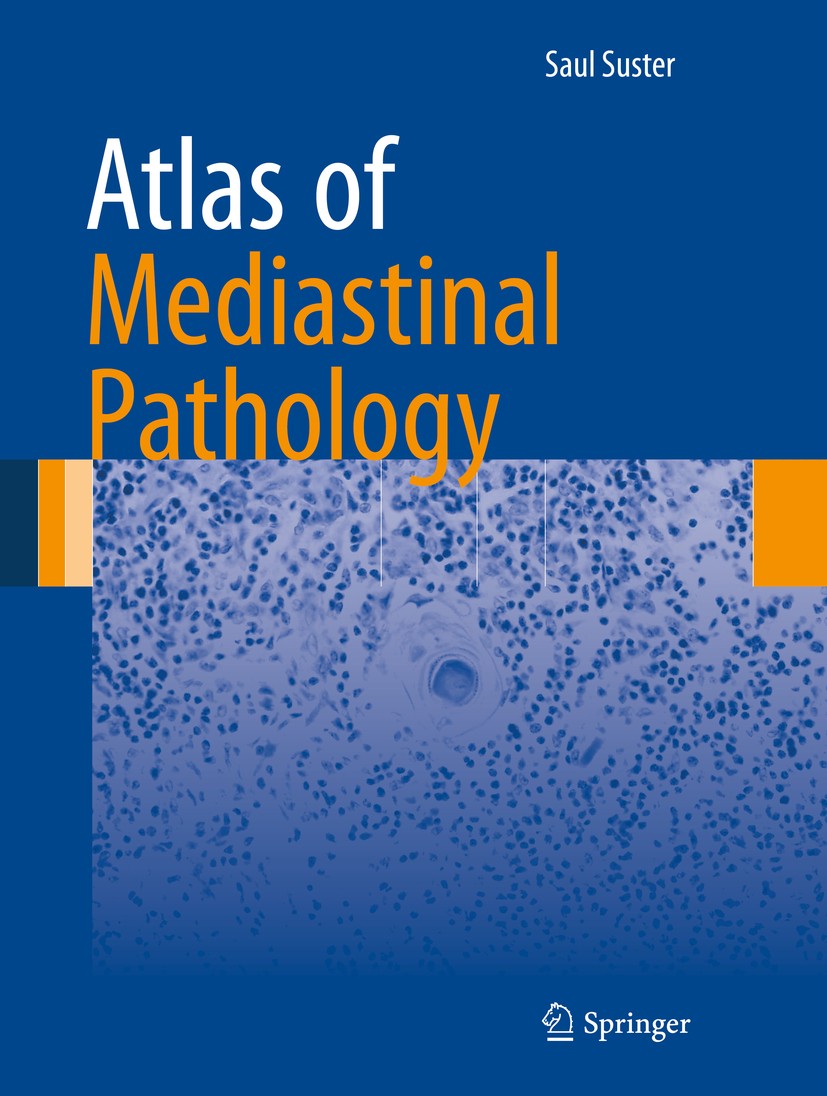Titlebook: Atlas of Mediastinal Pathology; Saul Suster Book 2015 Springer Science+Business Media, LLC 2015 angiosarcoma.chondrosarcoma.fibrothymolipo Titlebook: Atlas of Mediastinal Pathology; Saul Suster Book 2015 Springer Science+Business Media, LLC 2015 angiosarcoma.chondrosarcoma.fibrothymolipo