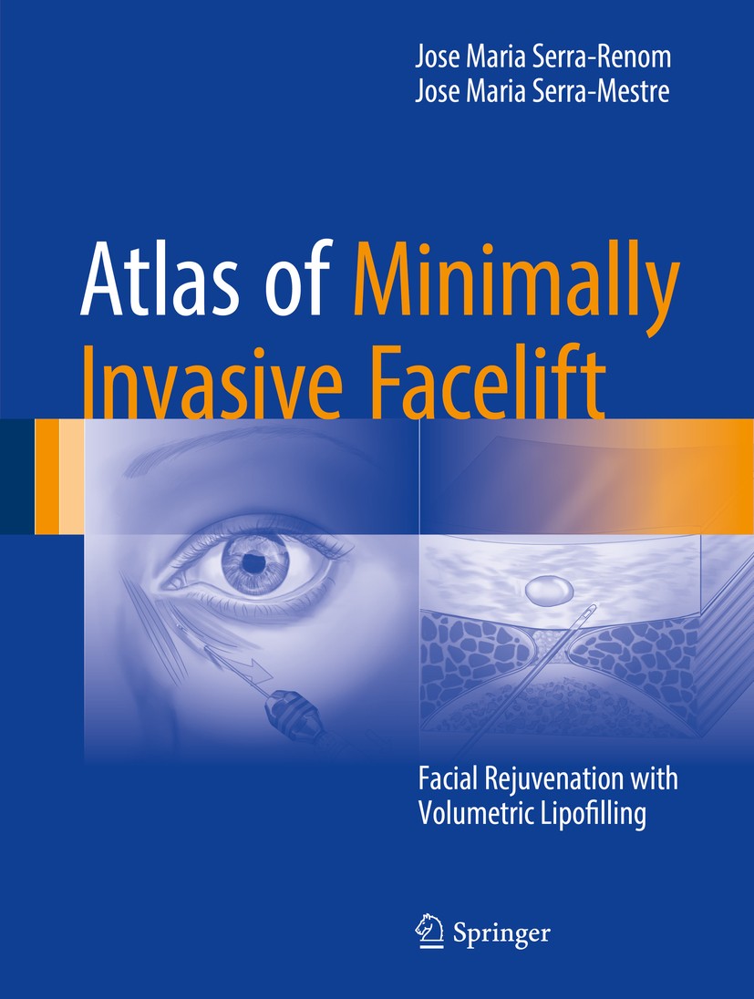 Titlebook: Atlas of Minimally Invasive Facelift; Facial Rejuvenation Jose Maria Serra-Renom,Jose Maria Serra-Mestre Book 2016 Springer International Titlebook: Atlas of Minimally Invasive Facelift; Facial Rejuvenation Jose Maria Serra-Renom,Jose Maria Serra-Mestre Book 2016 Springer International