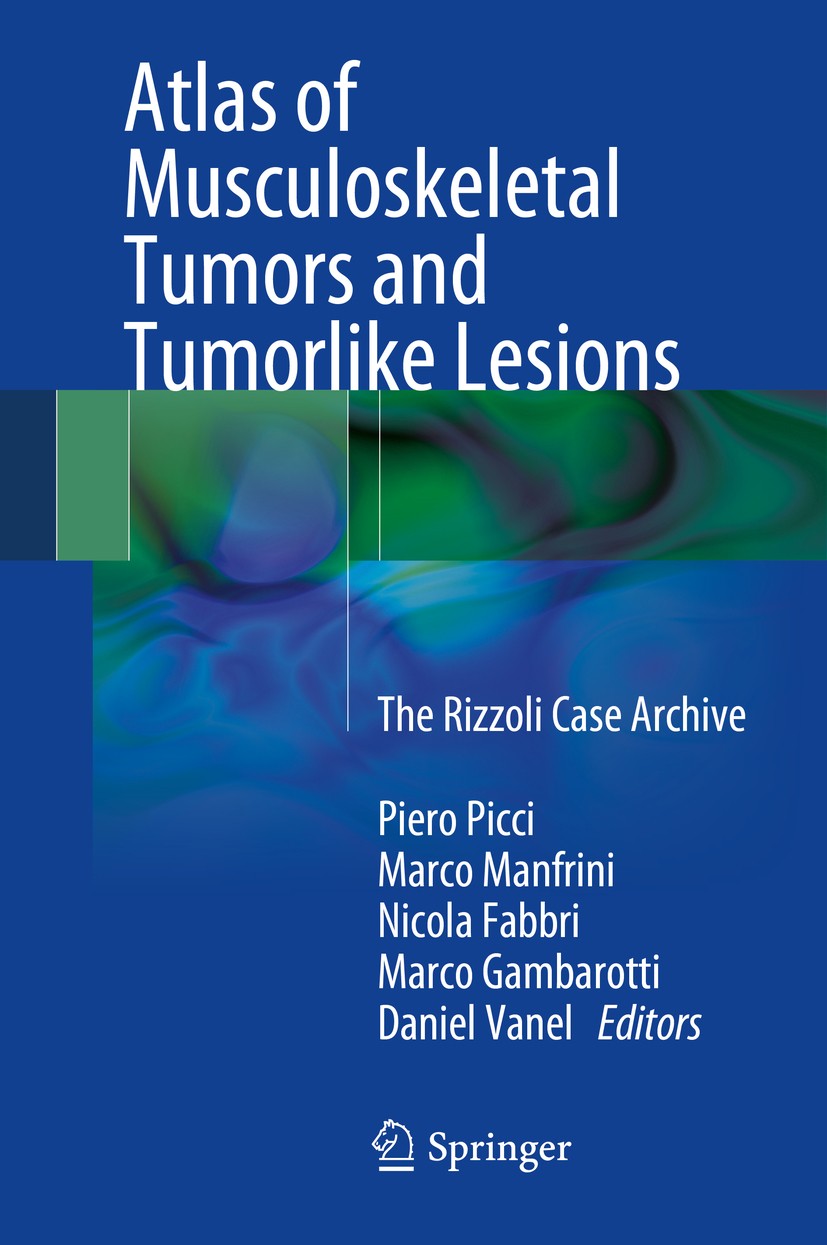 Titlebook: Atlas of Musculoskeletal Tumors and Tumorlike Lesions; The Rizzoli Case Arc Piero Picci,Marco Manfrini,Daniel Vanel Book 20141st edition Sp Titlebook: Atlas of Musculoskeletal Tumors and Tumorlike Lesions; The Rizzoli Case Arc Piero Picci,Marco Manfrini,Daniel Vanel Book 20141st edition Sp