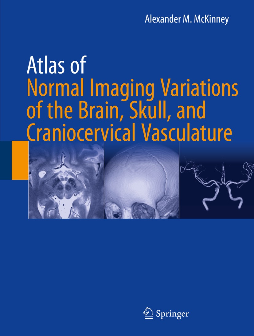 Titlebook: Atlas of Normal Imaging Variations of the Brain, Skull, and Craniocervical Vasculature; Alexander M. McKinney Book 2017 Springer Internati Titlebook: Atlas of Normal Imaging Variations of the Brain, Skull, and Craniocervical Vasculature; Alexander M. McKinney Book 2017 Springer Internati