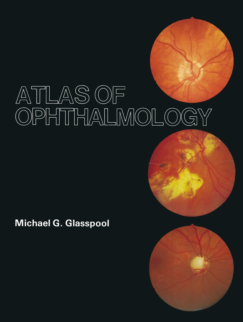 Titlebook: Atlas of Ophthalmology; Michael G. Glasspool Book 1982 M. G. Glasspool 1982 ophthalmology Titlebook: Atlas of Ophthalmology; Michael G. Glasspool Book 1982 M. G. Glasspool 1982 ophthalmology