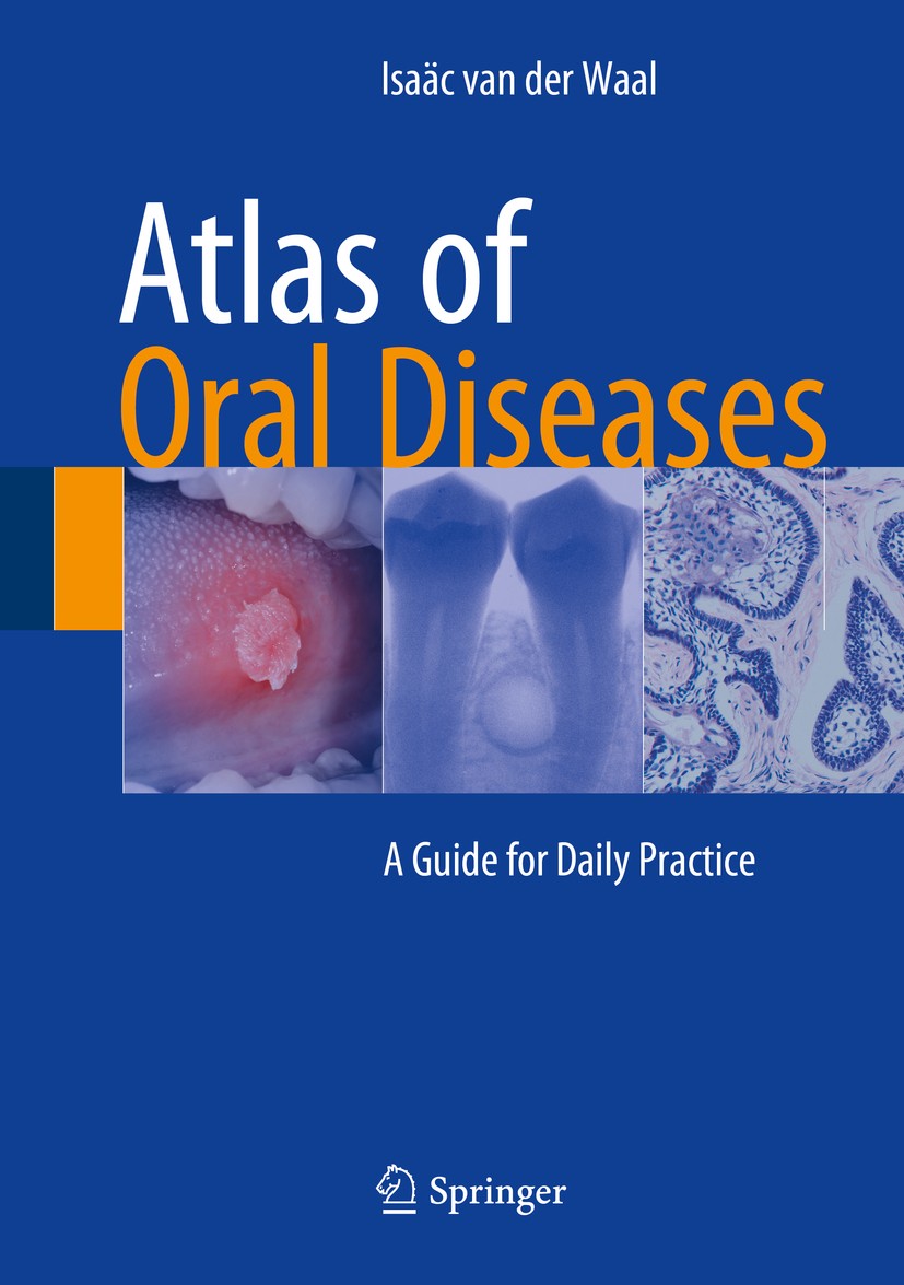 Titlebook: Atlas of Oral Diseases; A Guide for Daily Pr Isaäc van der Waal Book 2016 Springer Berlin Heidelberg 2016 Burning mouth syndrome.Jaw bones. Titlebook: Atlas of Oral Diseases; A Guide for Daily Pr Isaäc van der Waal Book 2016 Springer Berlin Heidelberg 2016 Burning mouth syndrome.Jaw bones.