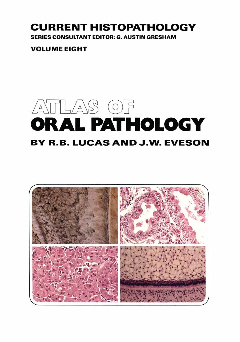 Titlebook: Atlas of Oral Pathology; R. B. Lucas,J. W. Eveson Book 1985 R. B. Lucas and J. W. Eveson 1985 pathology Titlebook: Atlas of Oral Pathology; R. B. Lucas,J. W. Eveson Book 1985 R. B. Lucas and J. W. Eveson 1985 pathology