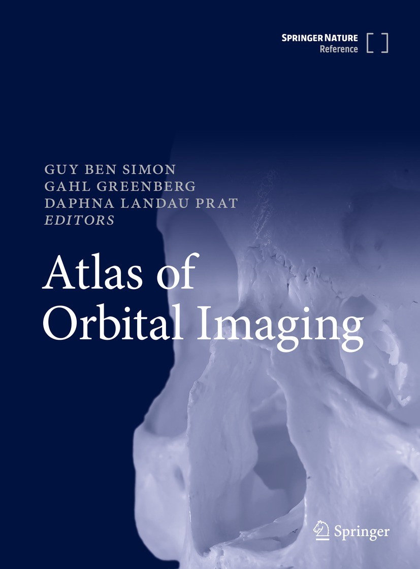 Titlebook: Atlas of Orbital Imaging; Guy Ben Simon,Gahl Greenberg,Daphna Landau Prat Reference work 2022 Springer Nature Switzerland AG 2022 CT.MRI.V Titlebook: Atlas of Orbital Imaging; Guy Ben Simon,Gahl Greenberg,Daphna Landau Prat Reference work 2022 Springer Nature Switzerland AG 2022 CT.MRI.V