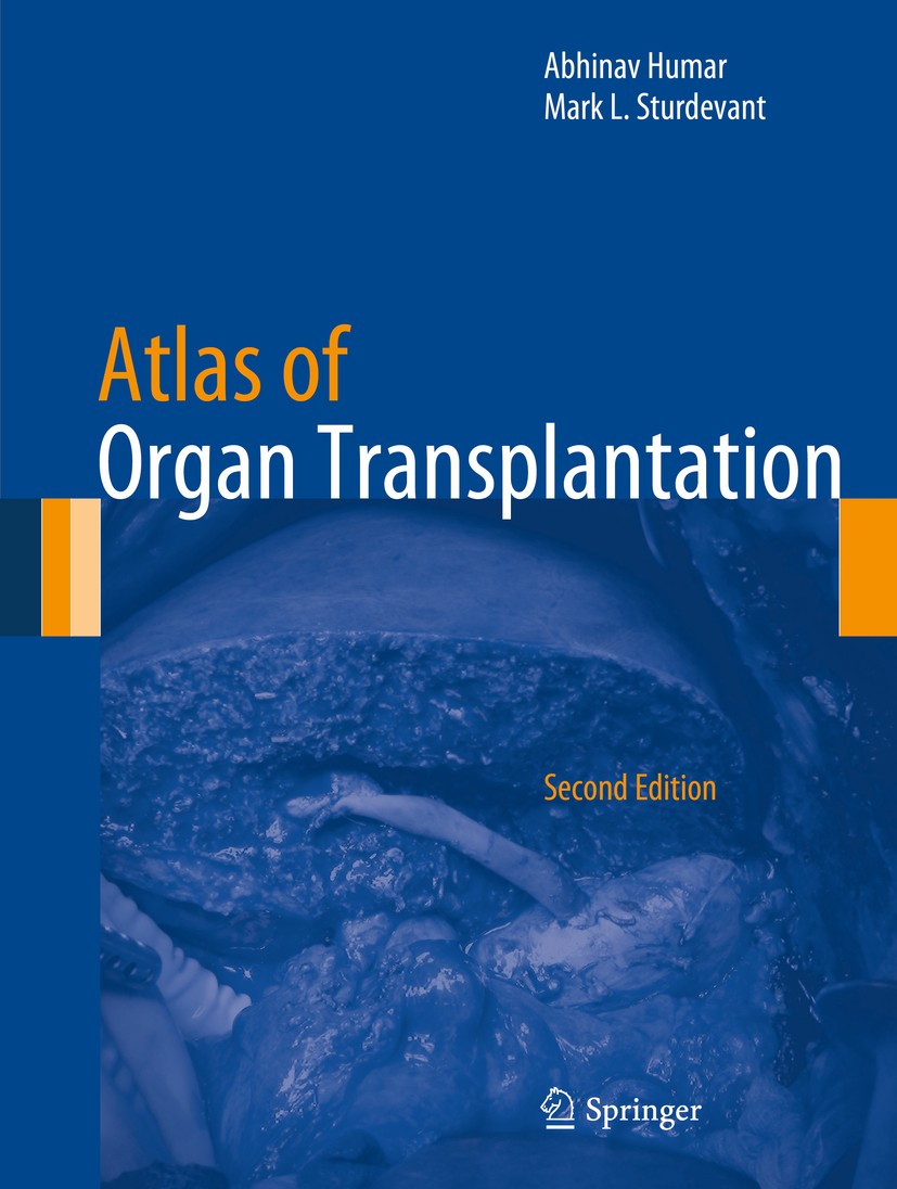 Titlebook: Atlas of Organ Transplantation; Abhinav Humar,Mark L. Sturdevant Book 2015Latest edition Springer-Verlag London 2015 Abdominal.Donor.Organ Titlebook: Atlas of Organ Transplantation; Abhinav Humar,Mark L. Sturdevant Book 2015Latest edition Springer-Verlag London 2015 Abdominal.Donor.Organ