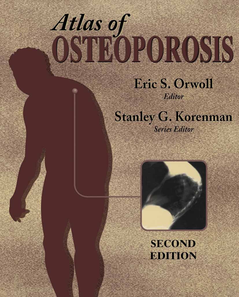 Titlebook: Atlas of Osteoporosis; Eric S. Orwoll (Professor of Medicine, Program Dir Book 2003Latest edition Springer Science+Business Media New York Titlebook: Atlas of Osteoporosis; Eric S. Orwoll (Professor of Medicine, Program Dir Book 2003Latest edition Springer Science+Business Media New York