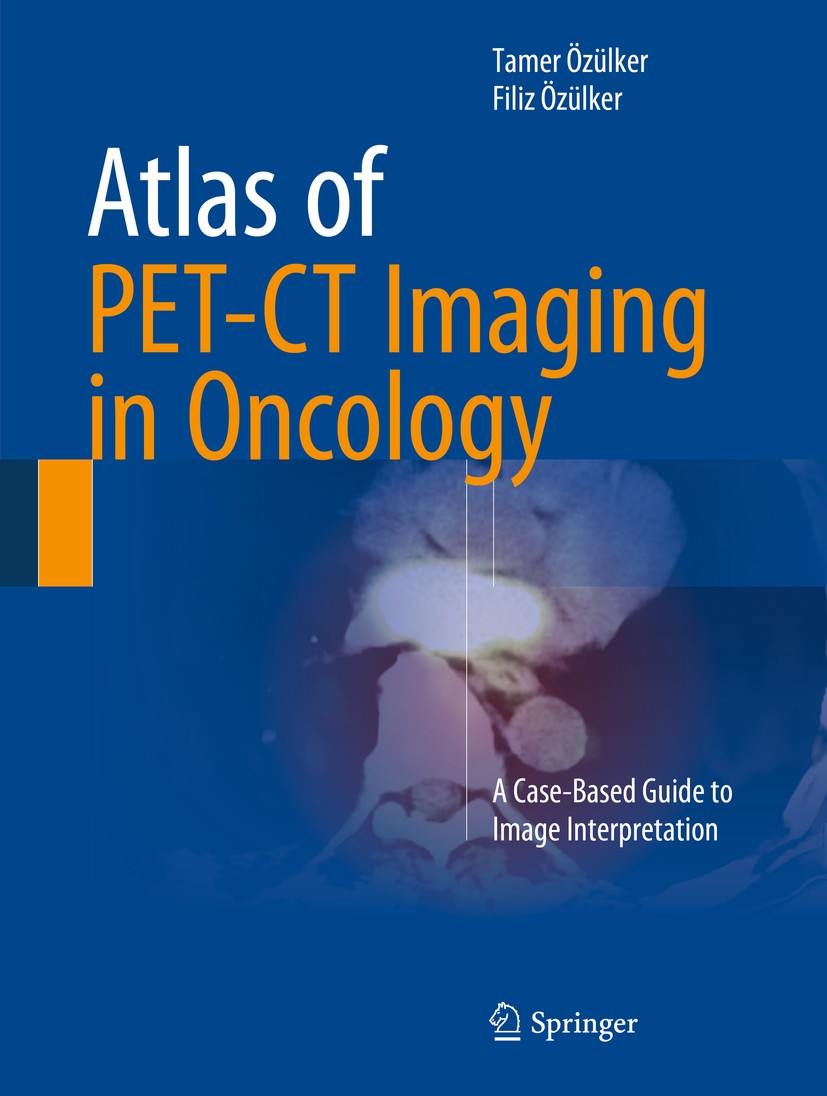 Titlebook: Atlas of PET-CT Imaging in Oncology; A Case-Based Guide t Tamer Özülker,Filiz Özülker Book 2015 Springer International Publishing Switzerla Titlebook: Atlas of PET-CT Imaging in Oncology; A Case-Based Guide t Tamer Özülker,Filiz Özülker Book 2015 Springer International Publishing Switzerla