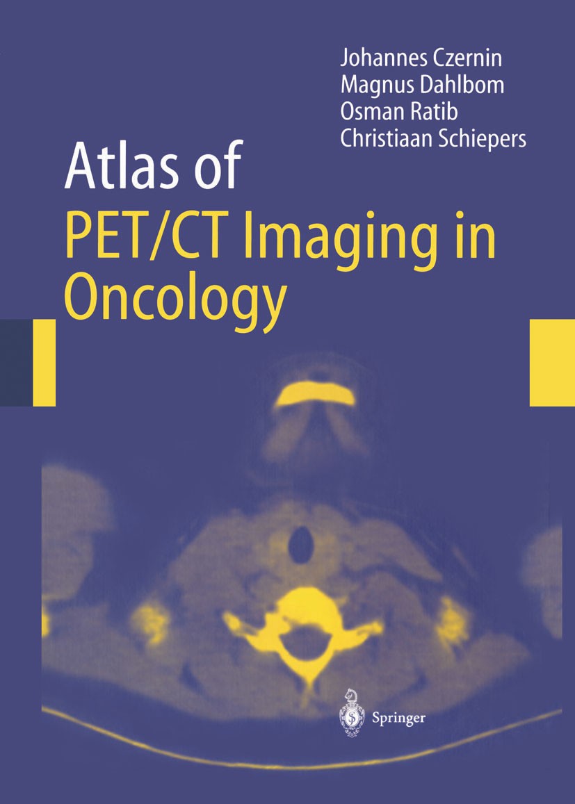 Titlebook: Atlas of PET/CT Imaging in Oncology; J. Czernin,M. Dahlbom,C. Schiepers Book 2004 Springer-Verlag Berlin Heidelberg 2004 Artifacts.Cancer Titlebook: Atlas of PET/CT Imaging in Oncology; J. Czernin,M. Dahlbom,C. Schiepers Book 2004 Springer-Verlag Berlin Heidelberg 2004 Artifacts.Cancer