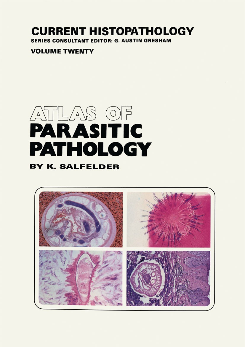 Titlebook: Atlas of Parasitic Pathology; K. Salfelder,T. R. Liscano,E. Sauerteig Book 1992 Springer Science+Business Media Dordrecht 1992 Malaria.Par Titlebook: Atlas of Parasitic Pathology; K. Salfelder,T. R. Liscano,E. Sauerteig Book 1992 Springer Science+Business Media Dordrecht 1992 Malaria.Par
