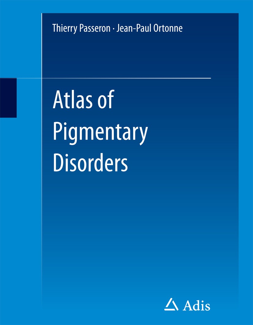 Titlebook: Atlas of Pigmentary Disorders; Thierry Passeron,Jean-Paul Ortonne Book 2016 The Editor(s) (if applicable) and The Author(s), under exclusi Titlebook: Atlas of Pigmentary Disorders; Thierry Passeron,Jean-Paul Ortonne Book 2016 The Editor(s) (if applicable) and The Author(s), under exclusi