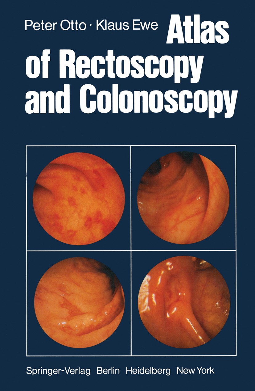 Titlebook: Atlas of Rectoscopy and Coloscopy; Peter Otto,Klaus Ewe Book 19791st edition Springer-Verlag Berlin Heidelberg 1979 Koloskopie.Rektoskopie Titlebook: Atlas of Rectoscopy and Coloscopy; Peter Otto,Klaus Ewe Book 19791st edition Springer-Verlag Berlin Heidelberg 1979 Koloskopie.Rektoskopie