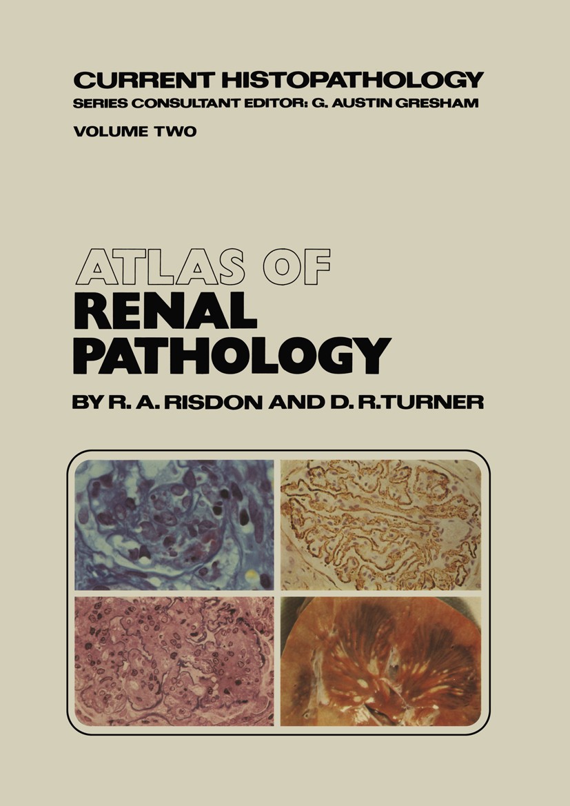 Titlebook: Atlas of Renal Pathology; R. A. Risdon,D. R. Turner Book 1980 Springer Science+Business Media Dordrecht 1980 pathology Titlebook: Atlas of Renal Pathology; R. A. Risdon,D. R. Turner Book 1980 Springer Science+Business Media Dordrecht 1980 pathology