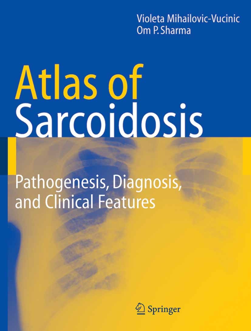 Titlebook: Atlas of Sarcoidosis; Pathogenesis, Diagno Violeta Mihailovic-Vucinic,Om P. Sharma Book 2005 Springer-Verlag London 2005 bone.dermatology.d Titlebook: Atlas of Sarcoidosis; Pathogenesis, Diagno Violeta Mihailovic-Vucinic,Om P. Sharma Book 2005 Springer-Verlag London 2005 bone.dermatology.d