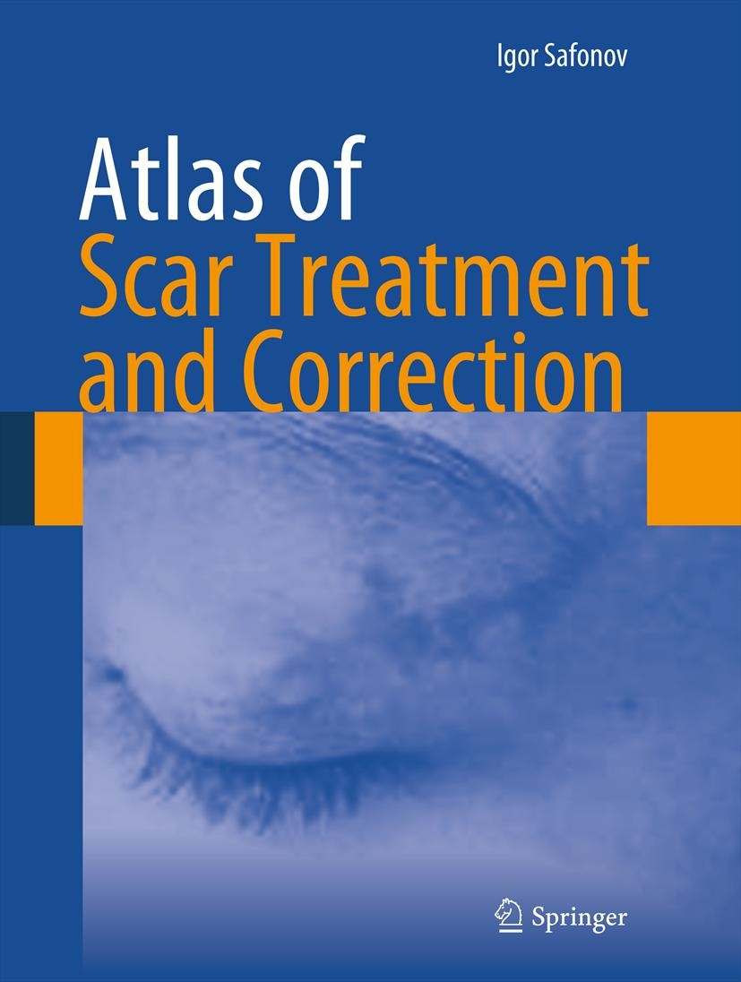 Titlebook: Atlas of Scar Treatment and Correction; Igor Safonov Book 2012 Springer-Verlag Berlin Heidelberg 2012 Acne scars.Keloids.Removal scars.Sca Titlebook: Atlas of Scar Treatment and Correction; Igor Safonov Book 2012 Springer-Verlag Berlin Heidelberg 2012 Acne scars.Keloids.Removal scars.Sca