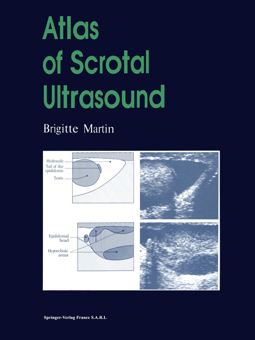 Titlebook: Atlas of Scrotal Ultrasound; Brigitte Martin Book 1992 Springer-Verlag France 1992 diagnosis.fertility.hoden.infertility.scrotum.surgery.t Titlebook: Atlas of Scrotal Ultrasound; Brigitte Martin Book 1992 Springer-Verlag France 1992 diagnosis.fertility.hoden.infertility.scrotum.surgery.t