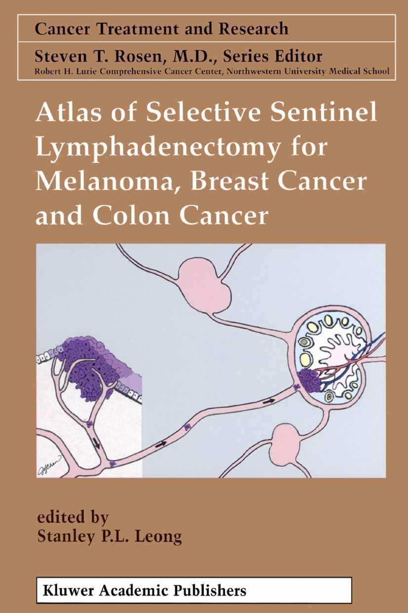 Titlebook: Atlas of Selective Sentinel Lymphadenectomy for Melanoma, Breast Cancer and Colon Cancer; Stanley P. L. Leong Book 2002 Springer Science+B Titlebook: Atlas of Selective Sentinel Lymphadenectomy for Melanoma, Breast Cancer and Colon Cancer; Stanley P. L. Leong Book 2002 Springer Science+B