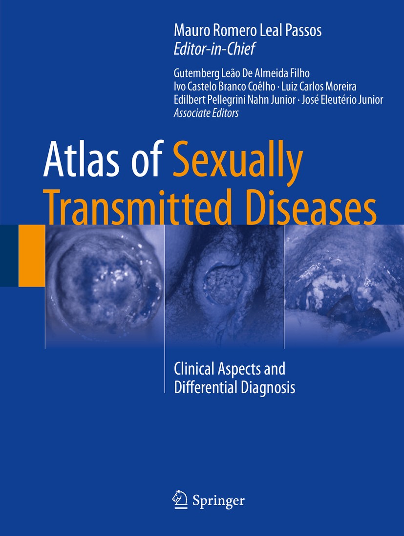 Titlebook: Atlas of Sexually Transmitted Diseases; Clinical Aspects and Mauro Romero Leal Passos Book 2018 Springer International Publishing AG 2018 A Titlebook: Atlas of Sexually Transmitted Diseases; Clinical Aspects and Mauro Romero Leal Passos Book 2018 Springer International Publishing AG 2018 A