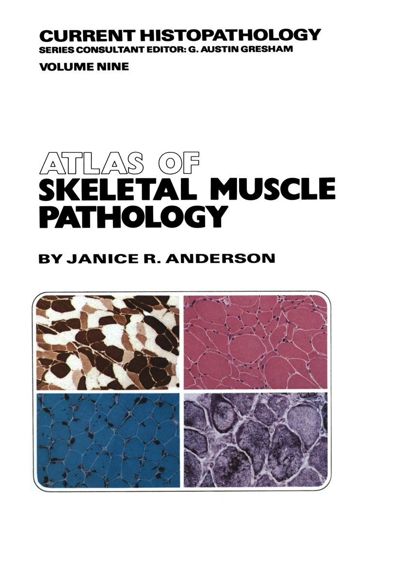 Titlebook: Atlas of Skeletal Muscle Pathology; Janice R. Anderson Book 1985 Janice R. Anderson 1985 inflammation.muscle.muscular dystrophy.pathology. Titlebook: Atlas of Skeletal Muscle Pathology; Janice R. Anderson Book 1985 Janice R. Anderson 1985 inflammation.muscle.muscular dystrophy.pathology.