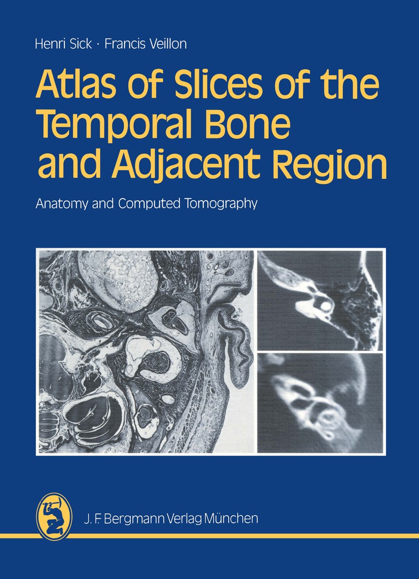Titlebook: Atlas of Slices of the Temporal Bone and Adjacent Region; Anatomy and Computed Henri Sick,Francis Veillon Book 1988 J. F. Bergmann Verlag, Titlebook: Atlas of Slices of the Temporal Bone and Adjacent Region; Anatomy and Computed Henri Sick,Francis Veillon Book 1988 J. F. Bergmann Verlag,