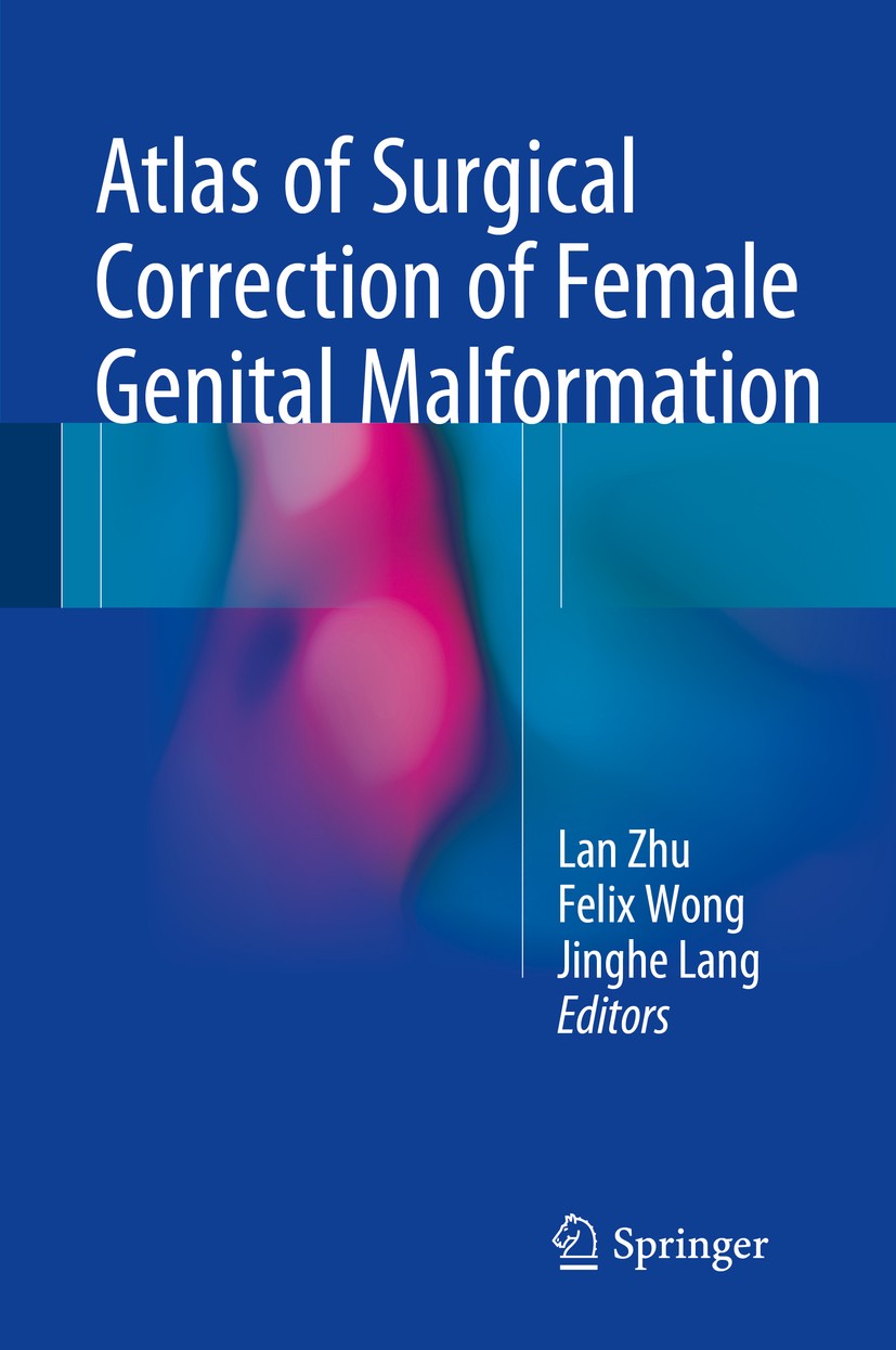 Titlebook: Atlas of Surgical Correction of Female Genital Malformation; Lan Zhu,Felix Wong,Jinghe Lang Book 2015 Springer Science+Business Media Dord Titlebook: Atlas of Surgical Correction of Female Genital Malformation; Lan Zhu,Felix Wong,Jinghe Lang Book 2015 Springer Science+Business Media Dord