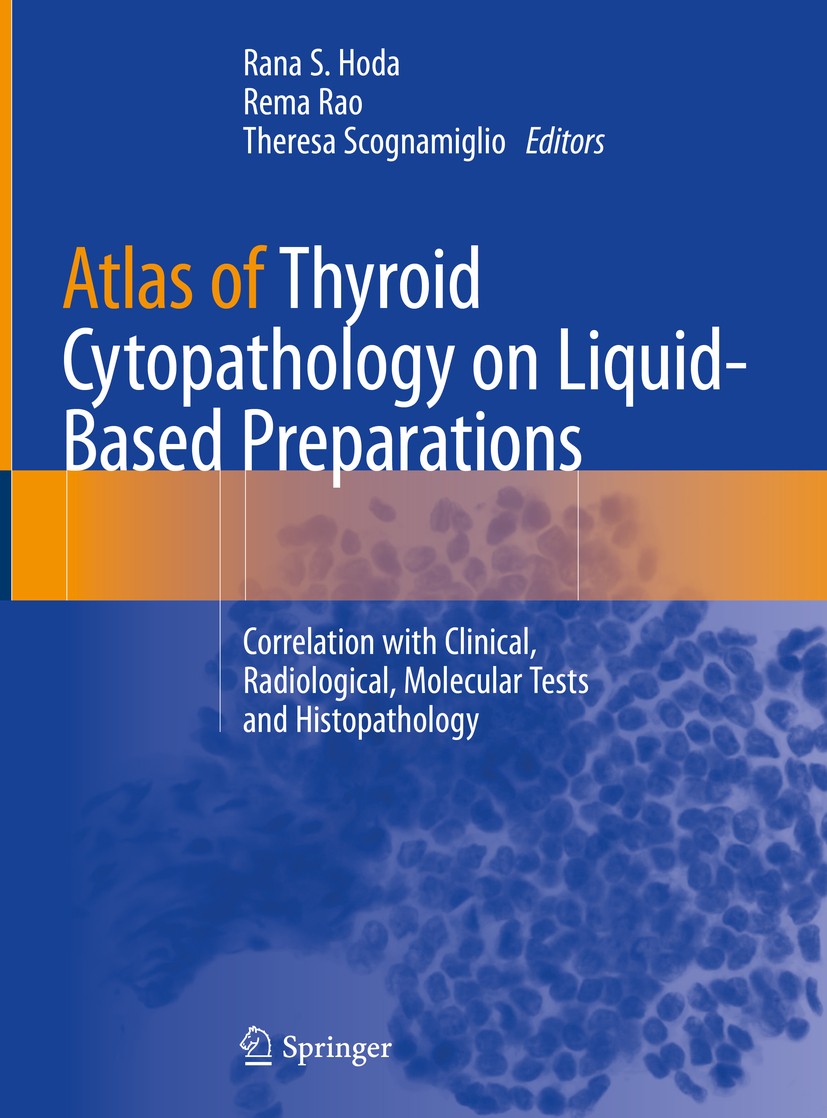 Titlebook: Atlas of Thyroid Cytopathology on Liquid-Based Preparations; Correlation with Cli Rana S. Hoda,Rema Rao,Theresa Scognamiglio Book 2020 Spri Titlebook: Atlas of Thyroid Cytopathology on Liquid-Based Preparations; Correlation with Cli Rana S. Hoda,Rema Rao,Theresa Scognamiglio Book 2020 Spri
