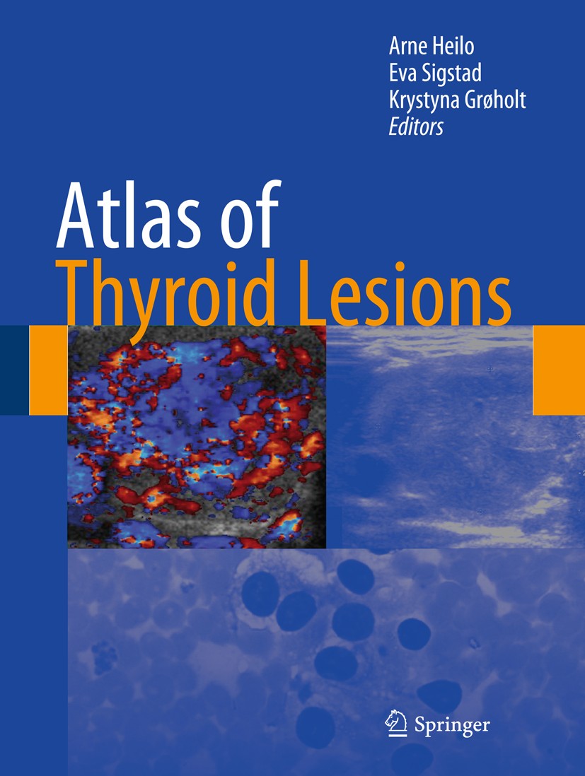 Titlebook: Atlas of Thyroid Lesions; Arne Heilo,Eva Sigstad,Krystyna Grøholt Book 2011 Springer Science+Business Media, LLC 2011 Atlas.Endocrinology. Titlebook: Atlas of Thyroid Lesions; Arne Heilo,Eva Sigstad,Krystyna Grøholt Book 2011 Springer Science+Business Media, LLC 2011 Atlas.Endocrinology.