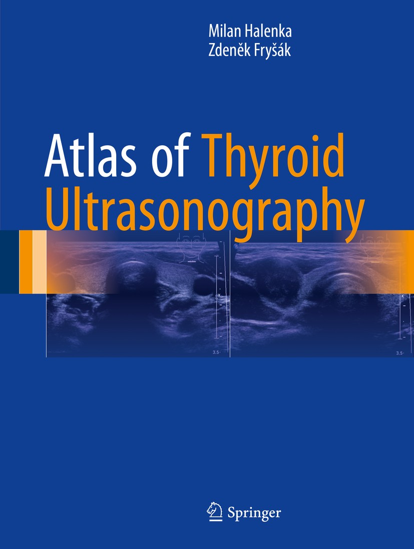 Titlebook: Atlas of Thyroid Ultrasonography; Milan Halenka,Zdeněk Fryšák Book 2017 Springer International Publishing AG 2017 Thyroid gland.Ultrasound Titlebook: Atlas of Thyroid Ultrasonography; Milan Halenka,Zdeněk Fryšák Book 2017 Springer International Publishing AG 2017 Thyroid gland.Ultrasound