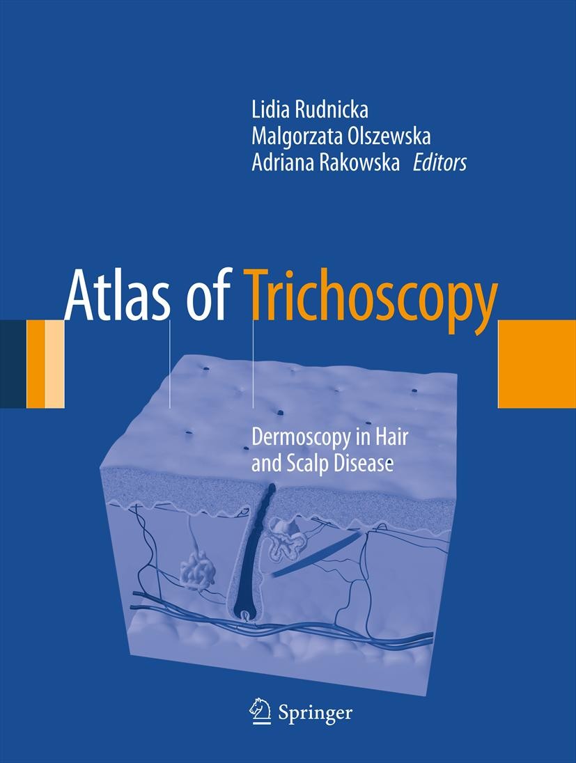 Titlebook: Atlas of Trichoscopy; Dermoscopy in Hair a Lidia Rudnicka,Malgorzata Olszewska,Adriana Rakows Book 2012 Springer-Verlag London 2012 Alopeci Titlebook: Atlas of Trichoscopy; Dermoscopy in Hair a Lidia Rudnicka,Malgorzata Olszewska,Adriana Rakows Book 2012 Springer-Verlag London 2012 Alopeci