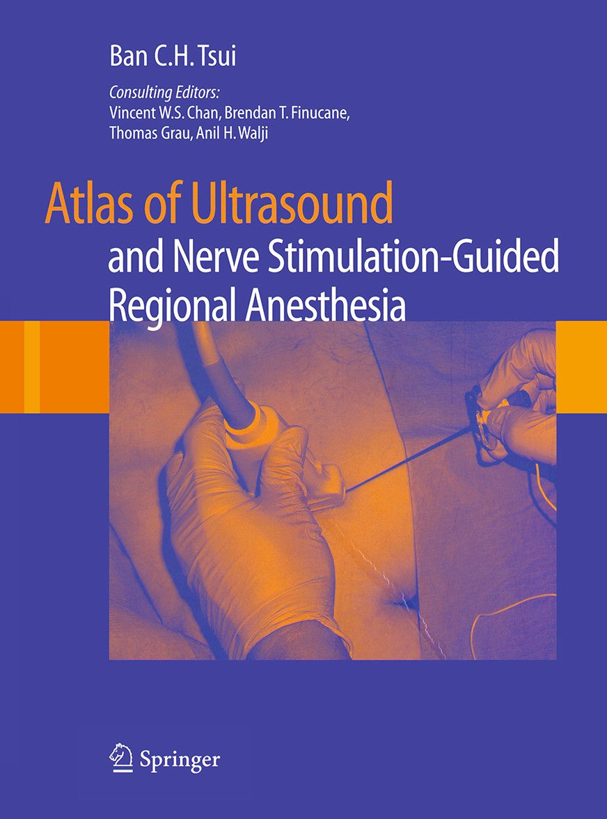 Titlebook: Atlas of Ultrasound- and Nerve Stimulation-Guided Regional Anesthesia; Ban C. H. Tsui,B. Pharm Book 2008 Springer-Verlag New York 2008 ane Titlebook: Atlas of Ultrasound- and Nerve Stimulation-Guided Regional Anesthesia; Ban C. H. Tsui,B. Pharm Book 2008 Springer-Verlag New York 2008 ane