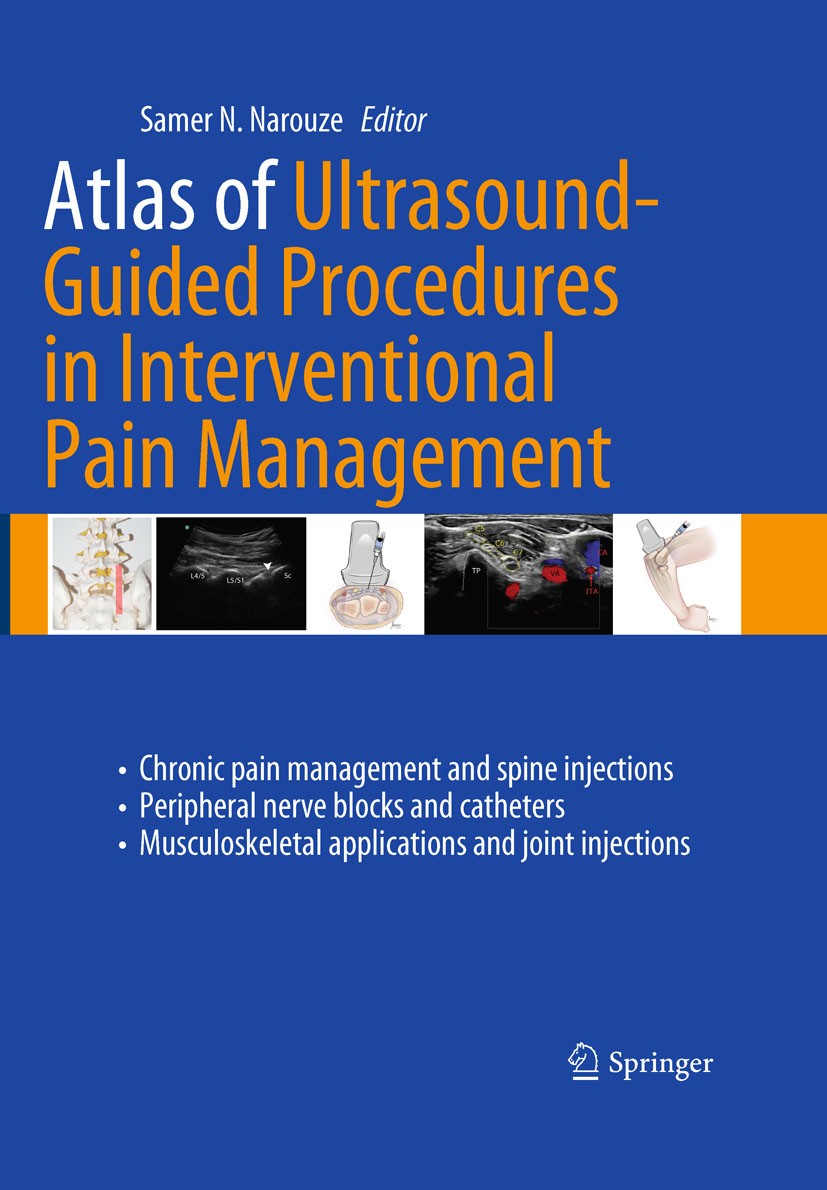 Titlebook: Atlas of Ultrasound-Guided Procedures in Interventional Pain Management; Samer N. Narouze Book 20111st edition The Editor(s) (if applicabl Titlebook: Atlas of Ultrasound-Guided Procedures in Interventional Pain Management; Samer N. Narouze Book 20111st edition The Editor(s) (if applicabl