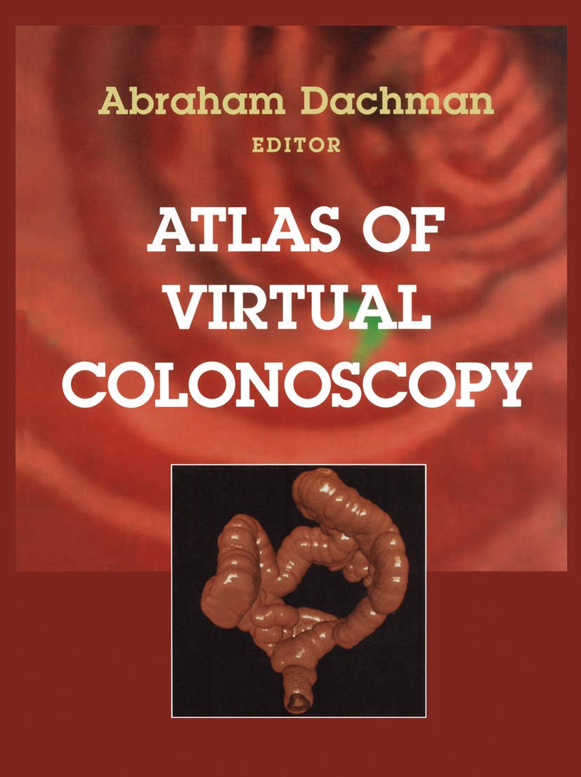 Titlebook: Atlas of Virtual Colonoscopy; Abraham H. Dachman (Professor of Clinical Radiolog Book 20031st edition Springer Science+Business Media New Titlebook: Atlas of Virtual Colonoscopy; Abraham H. Dachman (Professor of Clinical Radiolog Book 20031st edition Springer Science+Business Media New
