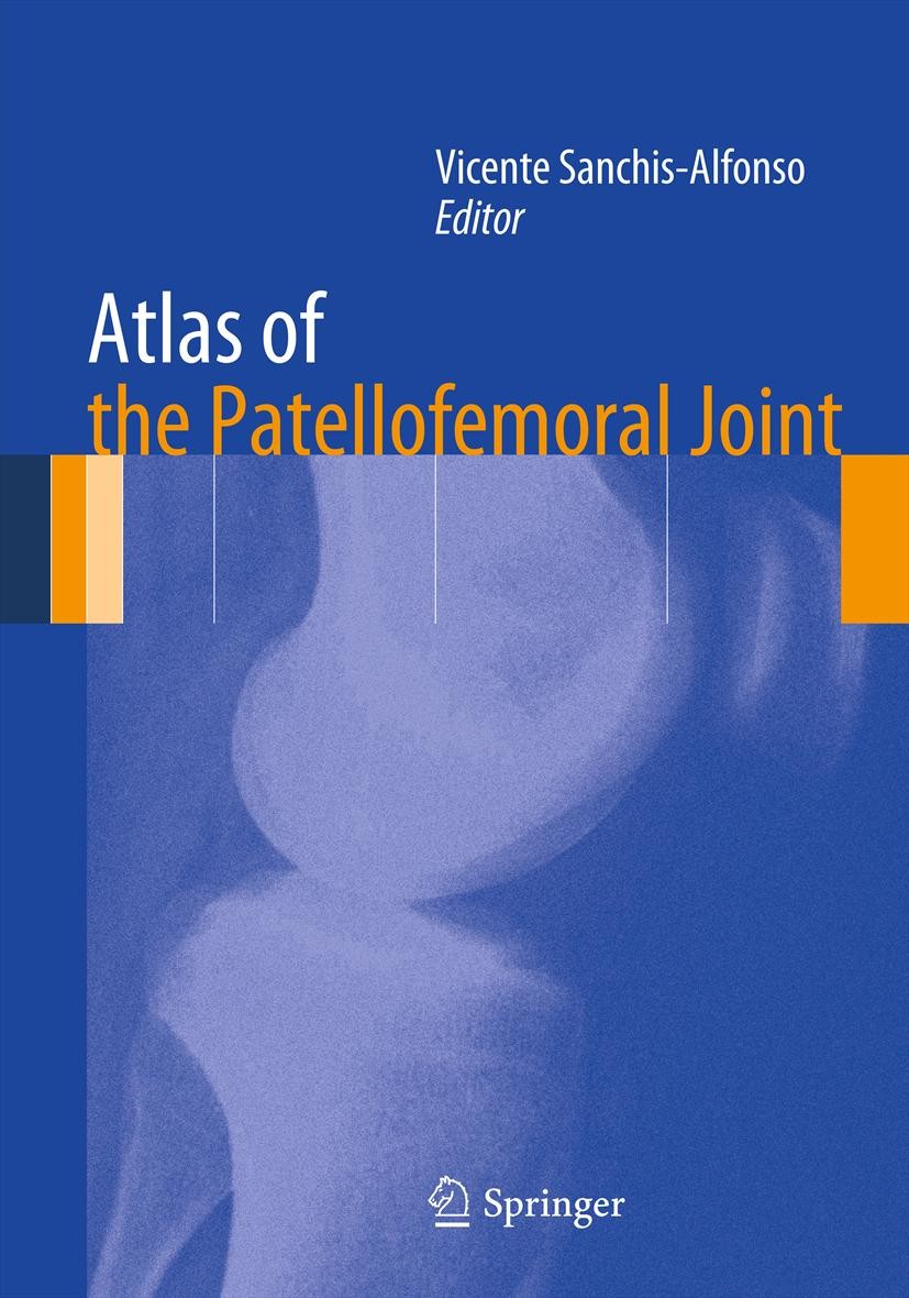 Titlebook: Atlas of the Patellofemoral Joint; Vicente Sanchis-Alfonso Book 2013 Springer-Verlag London 2013 Knee.Orthopedic.Patellofemoral Joint Titlebook: Atlas of the Patellofemoral Joint; Vicente Sanchis-Alfonso Book 2013 Springer-Verlag London 2013 Knee.Orthopedic.Patellofemoral Joint