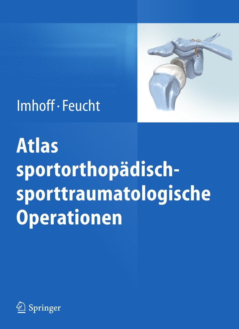 Titlebook: Atlas sportorthopädisch-sporttraumatologische Operationen; Andreas B. Imhoff,Matthias J. Feucht Book 20131st edition Springer-Verlag Berli Titlebook: Atlas sportorthopädisch-sporttraumatologische Operationen; Andreas B. Imhoff,Matthias J. Feucht Book 20131st edition Springer-Verlag Berli