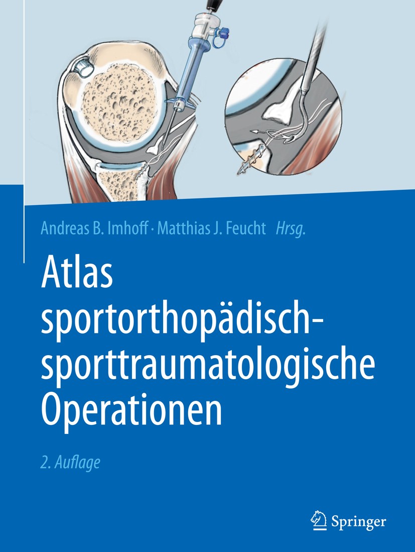 Titlebook: Atlas sportorthopädisch-sporttraumatologische Operationen; Andreas B. Imhoff,Matthias J. Feucht Book 2017Latest edition Springer-Verlag Gm Titlebook: Atlas sportorthopädisch-sporttraumatologische Operationen; Andreas B. Imhoff,Matthias J. Feucht Book 2017Latest edition Springer-Verlag Gm