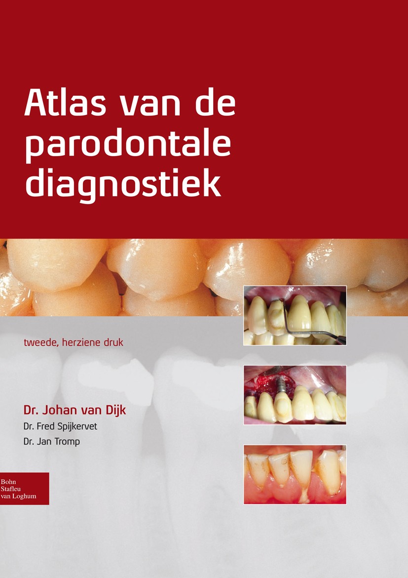 Titlebook: Atlas van de parodontale diagnostiek; Johan Dijk,Fred Spijkervet,Jan Tromp Book 2011Latest edition Bohn Stafleu van Loghum 2011 Titlebook: Atlas van de parodontale diagnostiek; Johan Dijk,Fred Spijkervet,Jan Tromp Book 2011Latest edition Bohn Stafleu van Loghum 2011