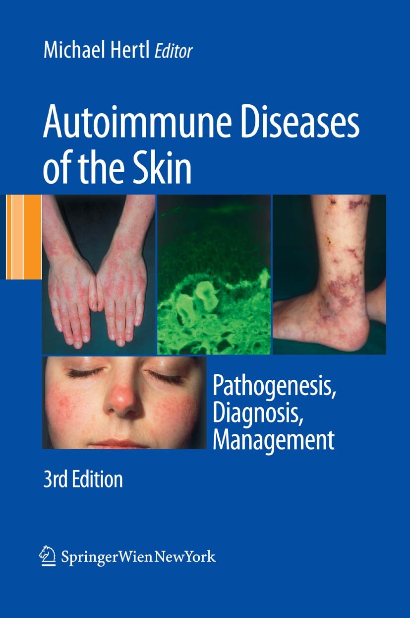 Titlebook: Autoimmune Diseases of the Skin; Pathogenesis, Diagno Michael Hertl Book 2011Latest edition Springer-Verlag Vienna 2011 Autoimmunkrankheite Titlebook: Autoimmune Diseases of the Skin; Pathogenesis, Diagno Michael Hertl Book 2011Latest edition Springer-Verlag Vienna 2011 Autoimmunkrankheite