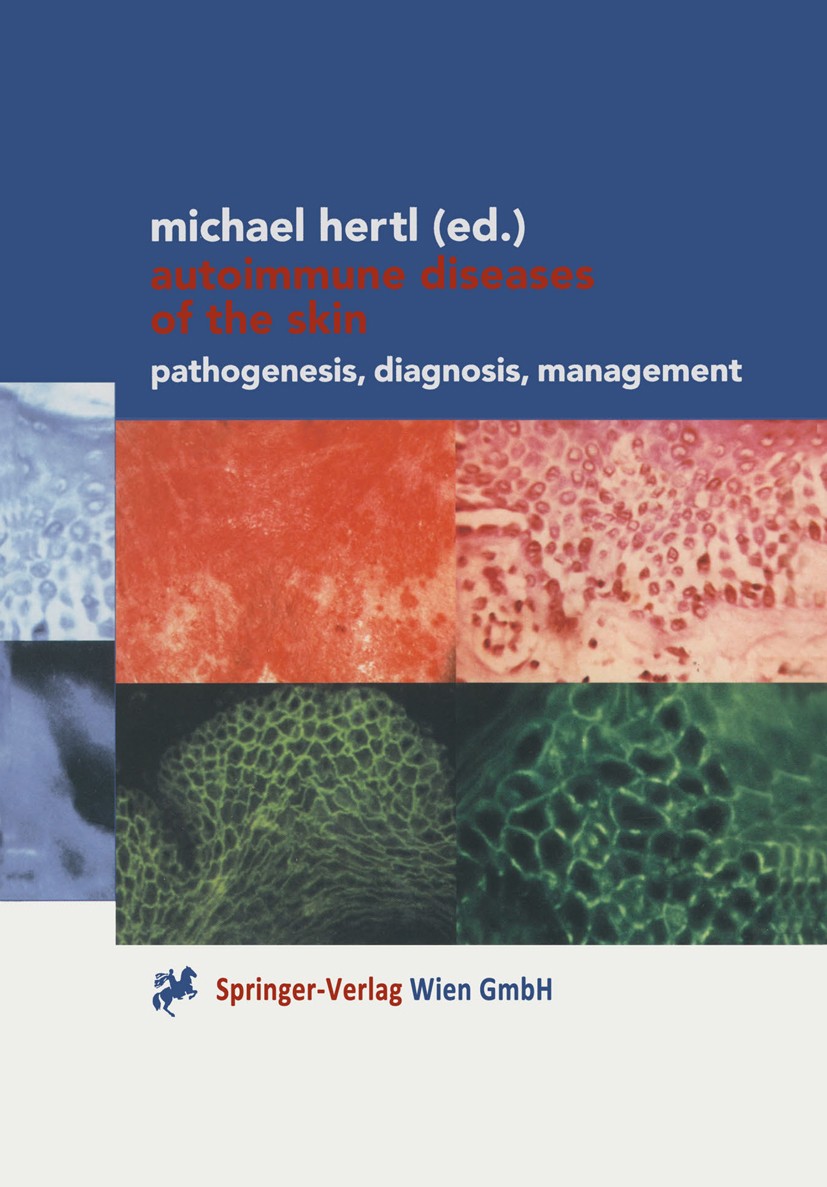 Titlebook: Autoimmune Diseases of the Skin; Pathogenesis, Diagno Michael Hertl (Professor of Dermatology) Book 20011st edition Springer-Verlag Wien 20 Titlebook: Autoimmune Diseases of the Skin; Pathogenesis, Diagno Michael Hertl (Professor of Dermatology) Book 20011st edition Springer-Verlag Wien 20