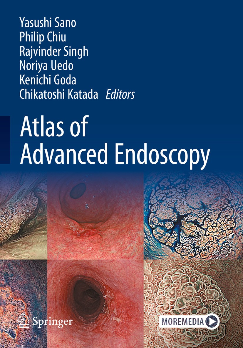 Titlebook: Atlas of Advanced Endoscopy; Yasushi Sano,Philip Chiu,Chikatoshi Katada Book 2024 The Editor(s) (if applicable) and The Author(s), under e Titlebook: Atlas of Advanced Endoscopy; Yasushi Sano,Philip Chiu,Chikatoshi Katada Book 2024 The Editor(s) (if applicable) and The Author(s), under e