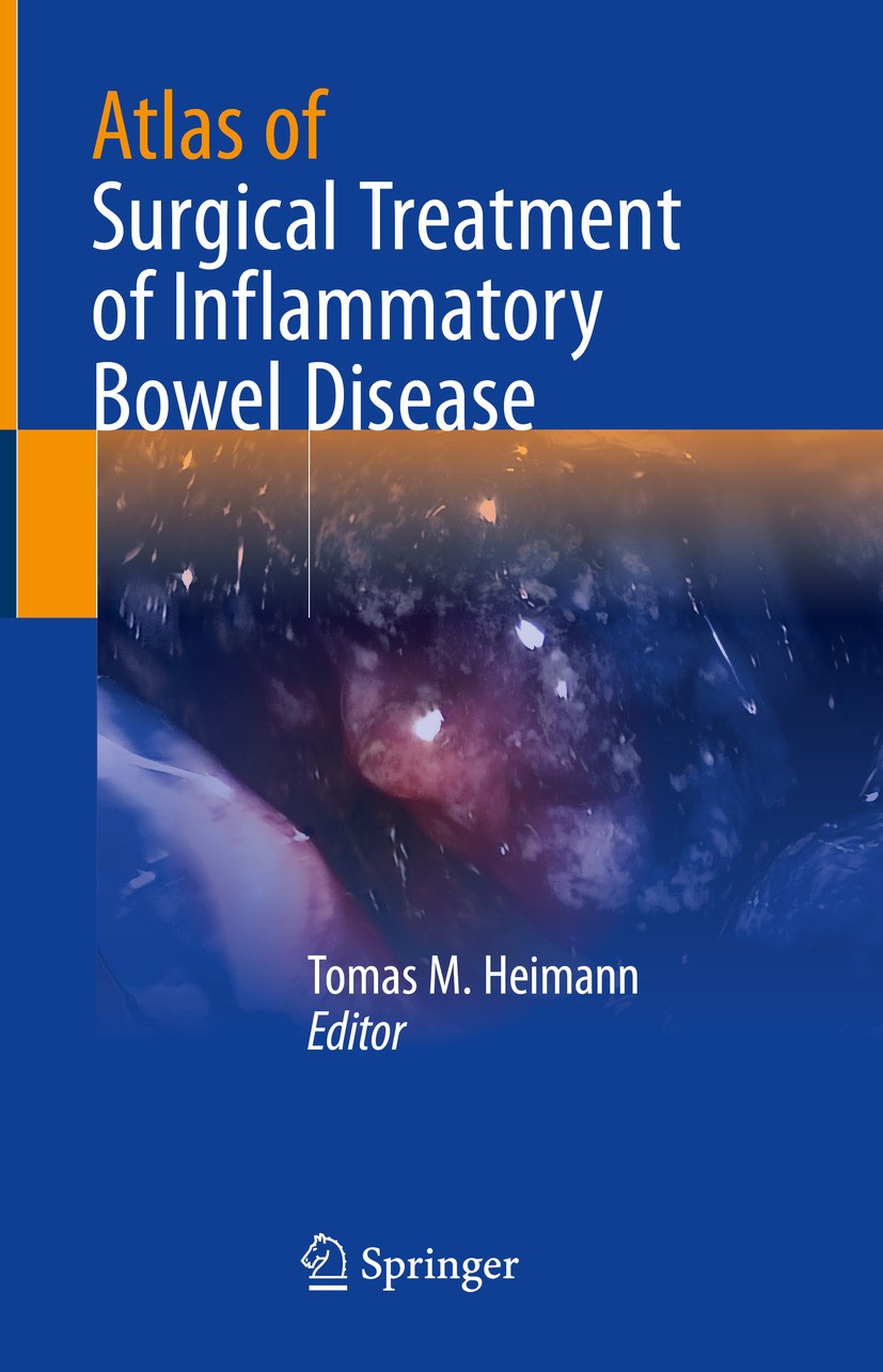 Titlebook: Atlas of Surgical Treatment of Inflammatory Bowel Disease; Tomas M. Heimann Book 2024 The Editor(s) (if applicable) and The Author(s), und Titlebook: Atlas of Surgical Treatment of Inflammatory Bowel Disease; Tomas M. Heimann Book 2024 The Editor(s) (if applicable) and The Author(s), und
