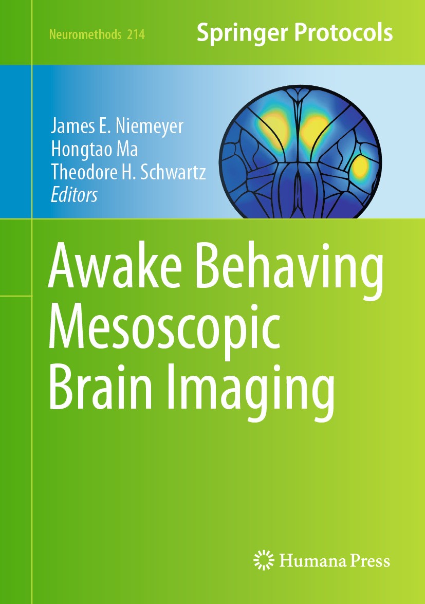 Titlebook: Awake Behaving Mesoscopic Brain Imaging; James E. Niemeyer,Hongtao Ma,Theodore H. Schwartz Book 2025 The Editor(s) (if applicable) and The Titlebook: Awake Behaving Mesoscopic Brain Imaging; James E. Niemeyer,Hongtao Ma,Theodore H. Schwartz Book 2025 The Editor(s) (if applicable) and The