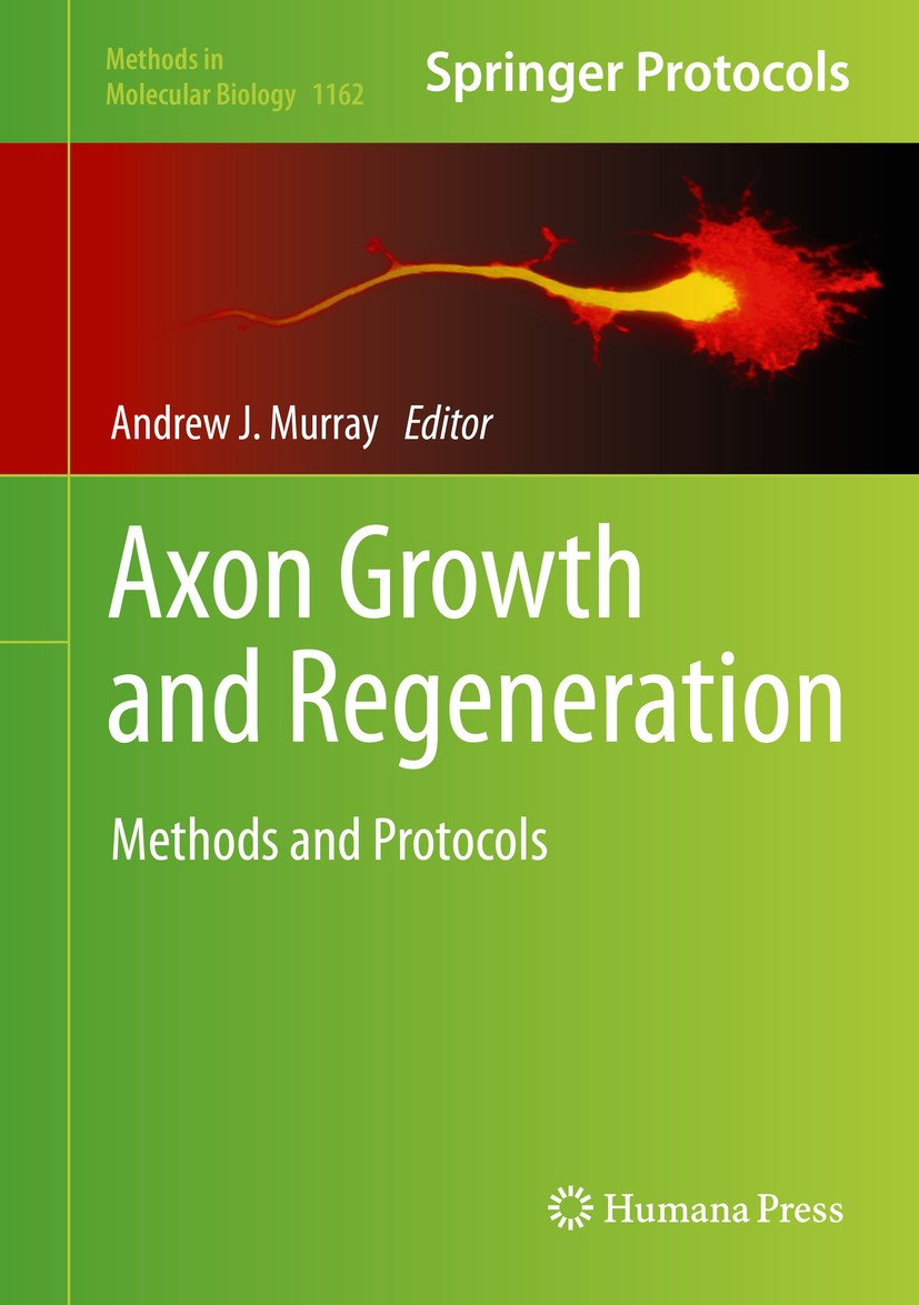 Titlebook: Axon Growth and Regeneration; Methods and Protocol Andrew J. Murray Book 2014 Springer Science+Business Media New York 2014 Axon growth.Axo Titlebook: Axon Growth and Regeneration; Methods and Protocol Andrew J. Murray Book 2014 Springer Science+Business Media New York 2014 Axon growth.Axo