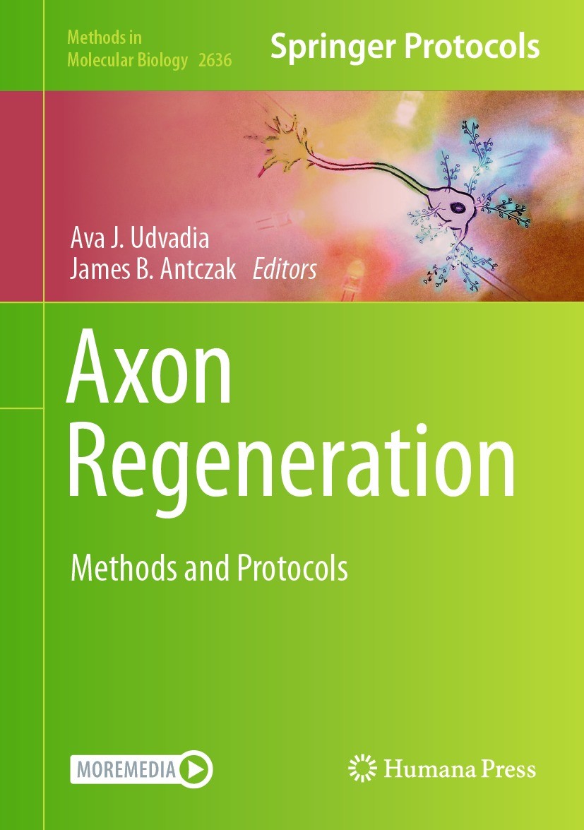 Titlebook: Axon Regeneration; Methods and Protocol Ava J. Udvadia,James B. Antczak Book 2023 The Editor(s) (if applicable) and The Author(s), under ex Titlebook: Axon Regeneration; Methods and Protocol Ava J. Udvadia,James B. Antczak Book 2023 The Editor(s) (if applicable) and The Author(s), under ex