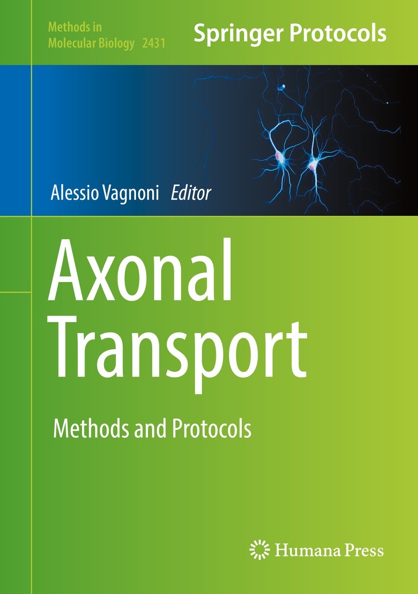 Titlebook: Axonal Transport; Methods and Protocol Alessio Vagnoni Book 2022 The Editor(s) (if applicable) and The Author(s), under exclusive license t Titlebook: Axonal Transport; Methods and Protocol Alessio Vagnoni Book 2022 The Editor(s) (if applicable) and The Author(s), under exclusive license t