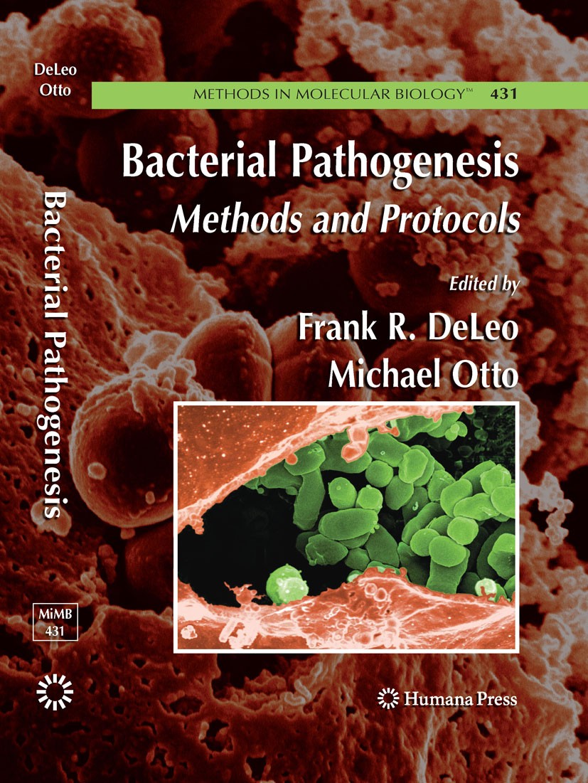 Titlebook: Bacterial Pathogenesis; Methods and Protocol Frank R. DeLeo,Michael Otto Book 2008 Humana Press 2008 Microarray.bacterial infection.bacteri Titlebook: Bacterial Pathogenesis; Methods and Protocol Frank R. DeLeo,Michael Otto Book 2008 Humana Press 2008 Microarray.bacterial infection.bacteri