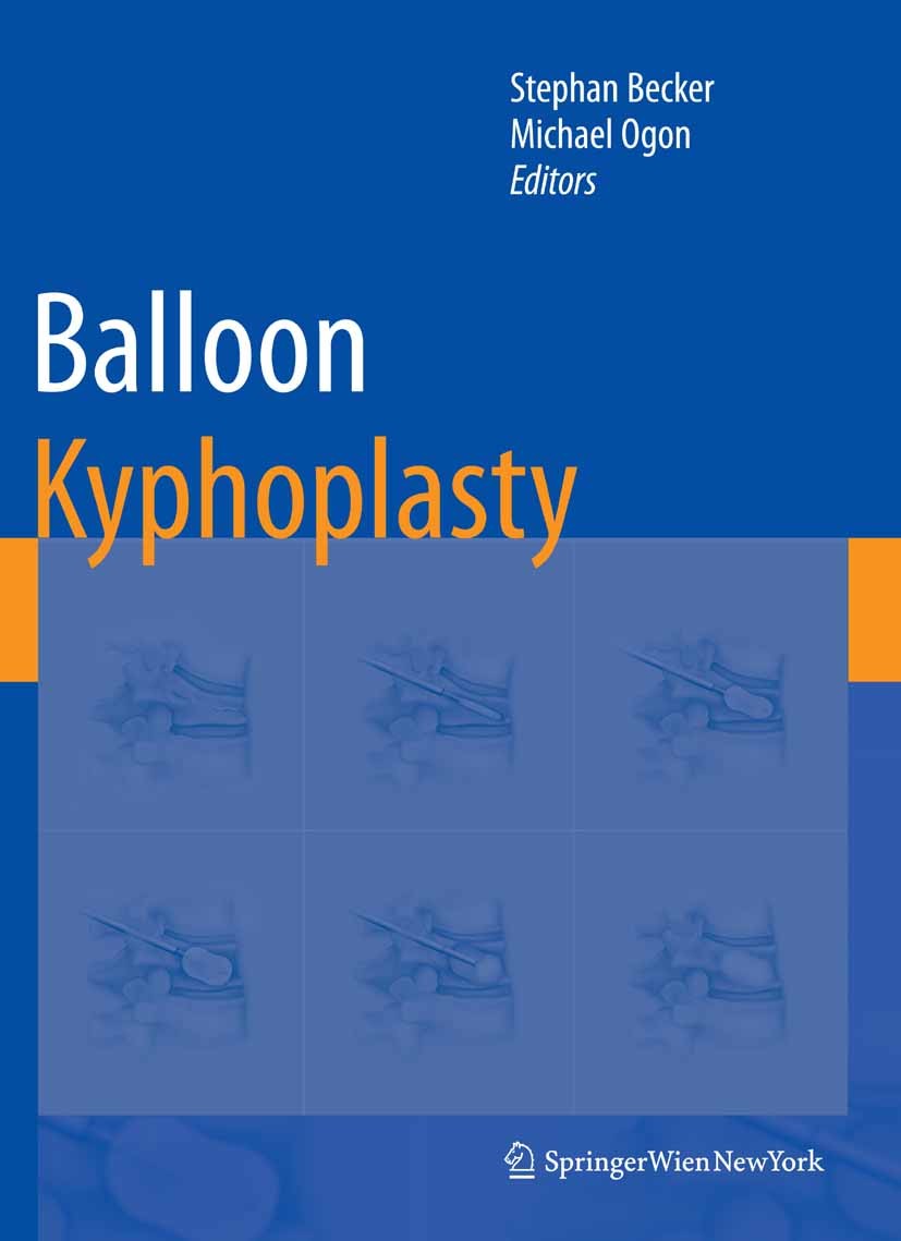 Titlebook: Balloon Kyphoplasty; Stephan Becker,Michael Ogon Book 2008 Springer-Verlag Vienna 2008 Tumor.anatomy.biomechanics.classification.complicat Titlebook: Balloon Kyphoplasty; Stephan Becker,Michael Ogon Book 2008 Springer-Verlag Vienna 2008 Tumor.anatomy.biomechanics.classification.complicat