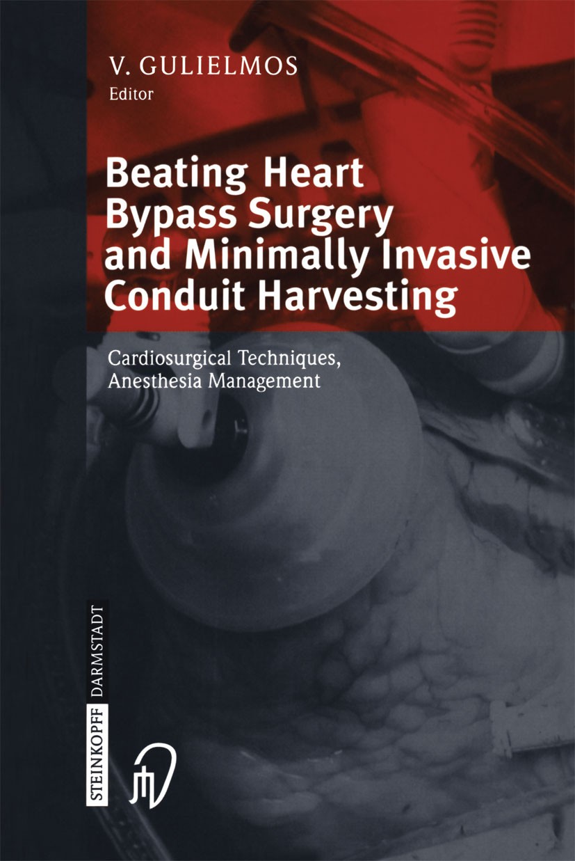 Titlebook: Beating Heart Bypass Surgery and Minimally Invasive Conduit Harvesting; Cardiosurgical Techn Vassilios Gulielmos Book 2004 Springer-Verlag Titlebook: Beating Heart Bypass Surgery and Minimally Invasive Conduit Harvesting; Cardiosurgical Techn Vassilios Gulielmos Book 2004 Springer-Verlag