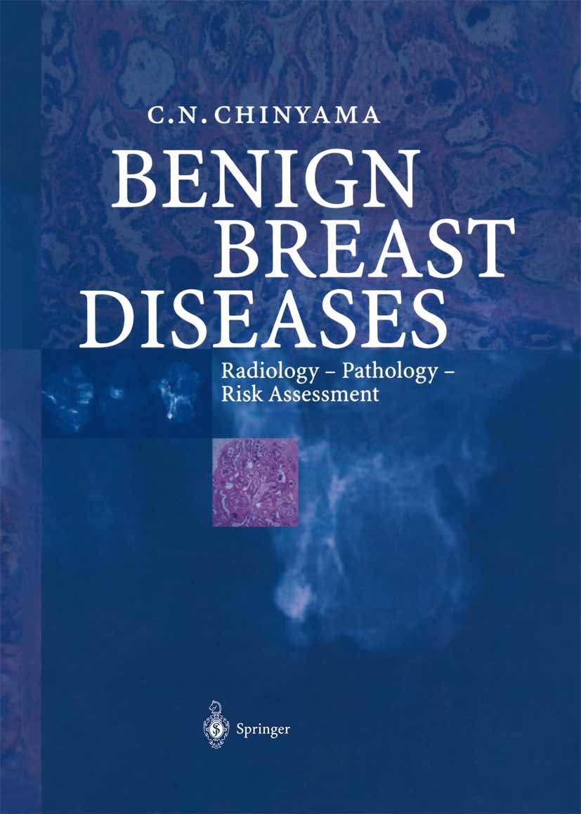Titlebook: Benign Breast Diseases; Radiology — Patholog Catherine N. Chinyama Book 20041st edition Springer-Verlag Berlin Heidelberg 2004 Benign.Breas Titlebook: Benign Breast Diseases; Radiology — Patholog Catherine N. Chinyama Book 20041st edition Springer-Verlag Berlin Heidelberg 2004 Benign.Breas
