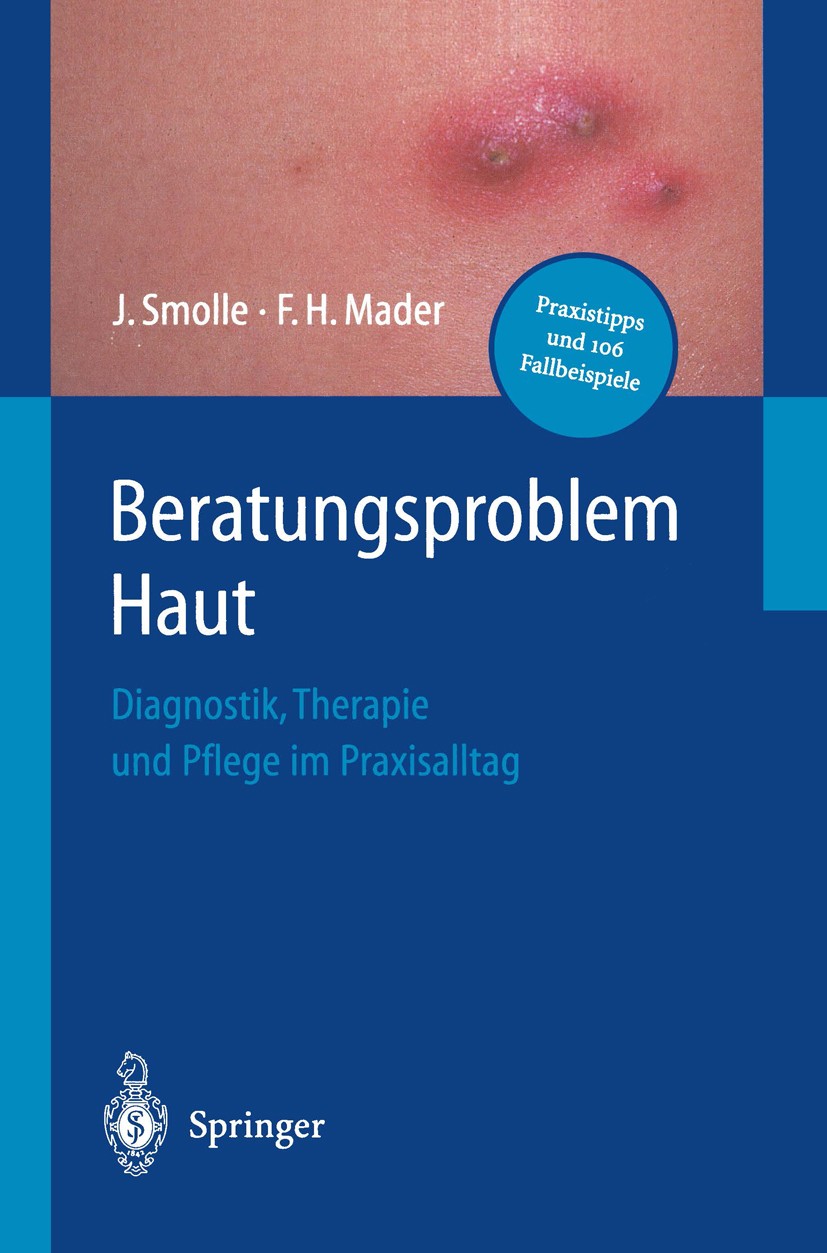 Titlebook: Beratungsproblem Haut; Diagnostik, Therapie Josef Smolle,Frank H. Mader Book 20011st edition Springer-Verlag Berlin Heidelberg 2001 Allgeme Titlebook: Beratungsproblem Haut; Diagnostik, Therapie Josef Smolle,Frank H. Mader Book 20011st edition Springer-Verlag Berlin Heidelberg 2001 Allgeme