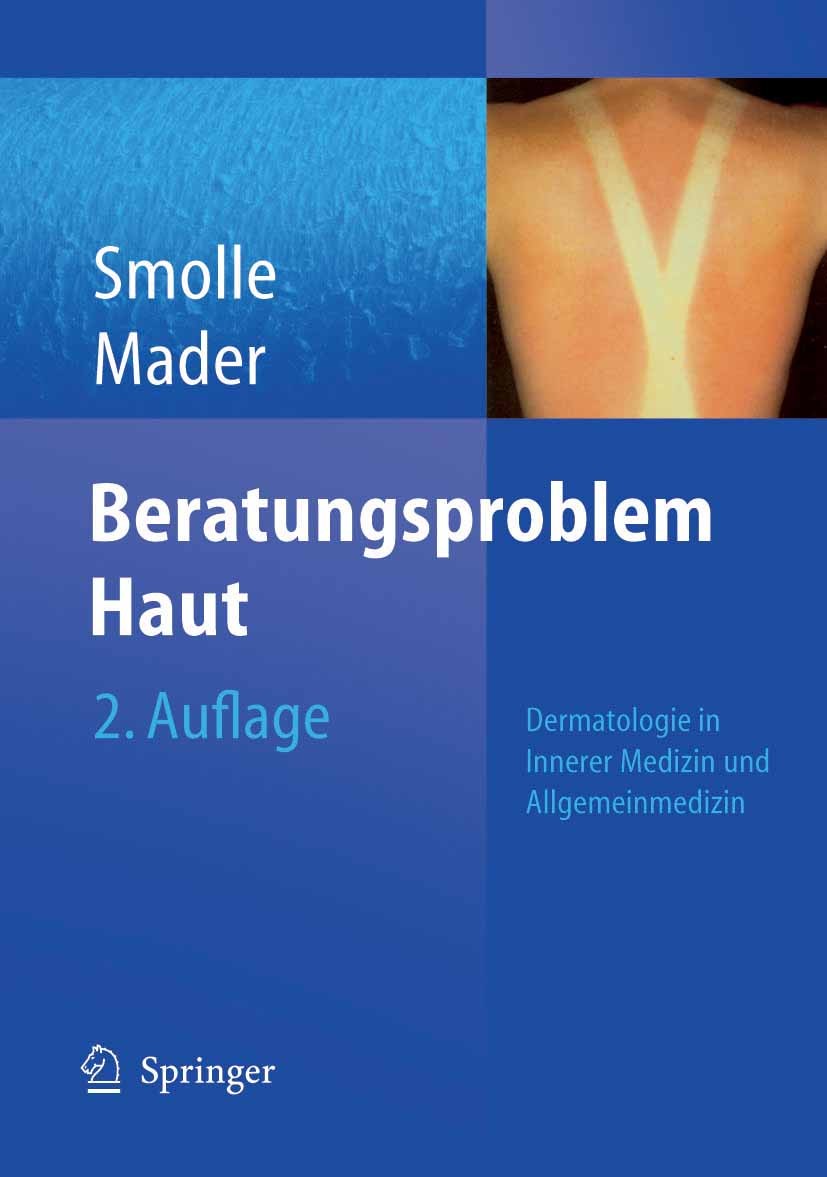 Titlebook: Beratungsproblem Haut; Dermatologie in Inne Josef Smolle,Frank H. Mader Book 2005Latest edition Springer-Verlag Berlin Heidelberg 2005 Akne Titlebook: Beratungsproblem Haut; Dermatologie in Inne Josef Smolle,Frank H. Mader Book 2005Latest edition Springer-Verlag Berlin Heidelberg 2005 Akne