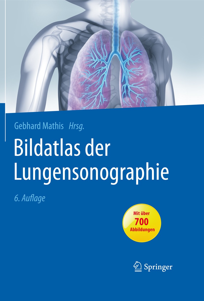 Titlebook: Bildatlas der Lungensonographie; Gebhard Mathis Book 20166th edition Springer-Verlag Berlin Heidelberg 2016 Diagnose.Diagnostik.Endosonogr Titlebook: Bildatlas der Lungensonographie; Gebhard Mathis Book 20166th edition Springer-Verlag Berlin Heidelberg 2016 Diagnose.Diagnostik.Endosonogr